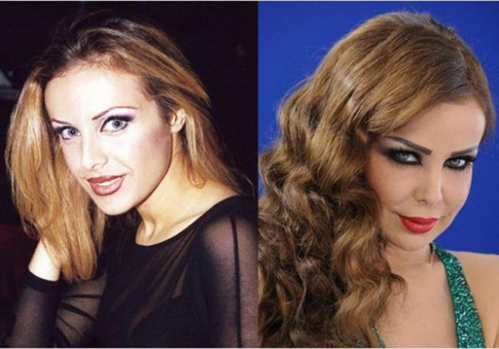 نجمات هن الأكثر توفيقاً في العمليات التجميلية عبر التاريخ!  صورة رقم 12