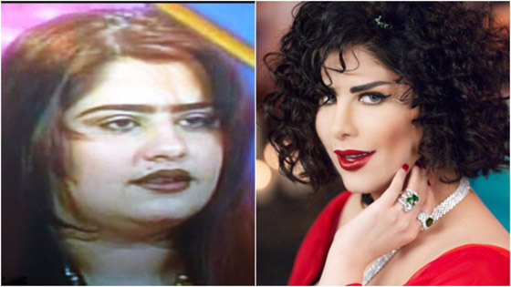 نجمات هن الأكثر توفيقاً في العمليات التجميلية عبر التاريخ!  صورة رقم 13