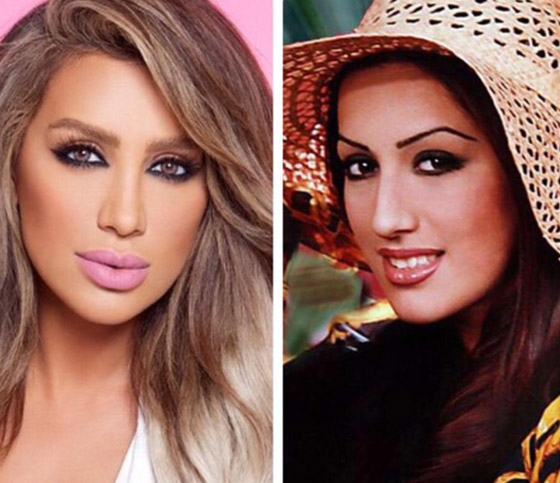 نجمات هن الأكثر توفيقاً في العمليات التجميلية عبر التاريخ!  صورة رقم 16