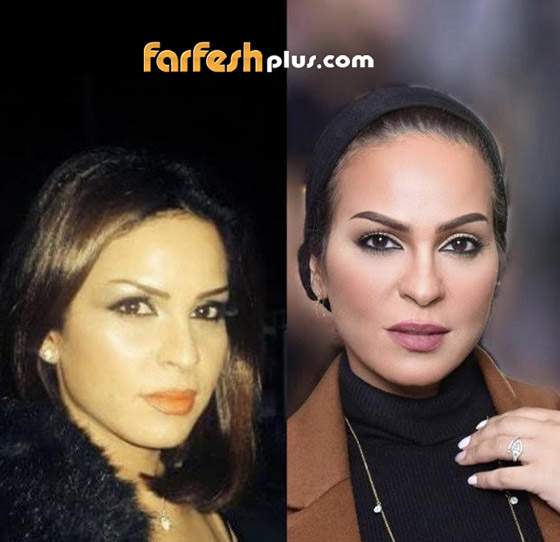 والدةُ حلا الترك تتخلّى عن الحِجاب.. والجمهور يهاجمها! صورة رقم 2