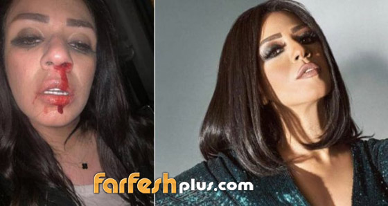 بين الخُلع والضرر والضرب نجمات في المحاكم! صورة رقم 3