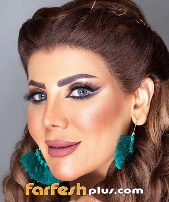 بعد عملية تجميل فاشلة.. الفنانة الكويتية إلهام الفضالة: أنا نادمة! صورة رقم 4