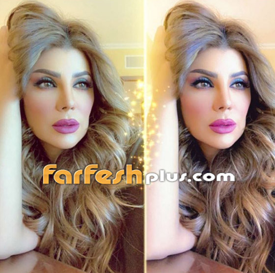 بعد عملية تجميل فاشلة.. الفنانة الكويتية إلهام الفضالة: أنا نادمة! صورة رقم 1