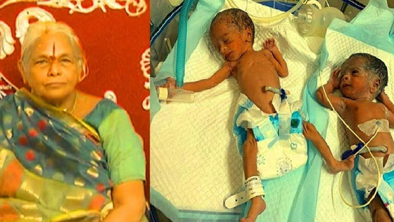 مُسنة هندية تلد طفلة وزنها 600 غرام فقط لتصبح أكبر أم تُنجب في العالم صورة رقم 3