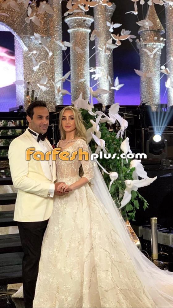 بعد مرضها المرعب في شهر العسل.. كشف سر تدهور صحة هنا الزاهد صورة رقم 18