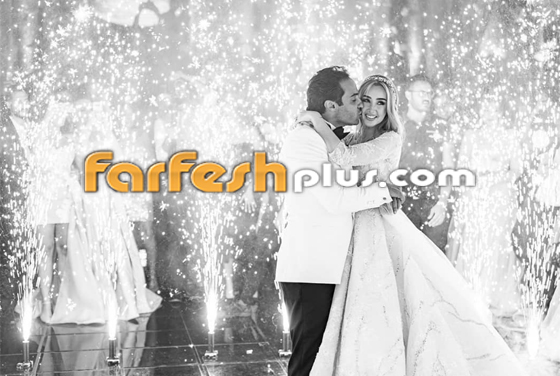 بعد مرضها المرعب في شهر العسل.. كشف سر تدهور صحة هنا الزاهد صورة رقم 14