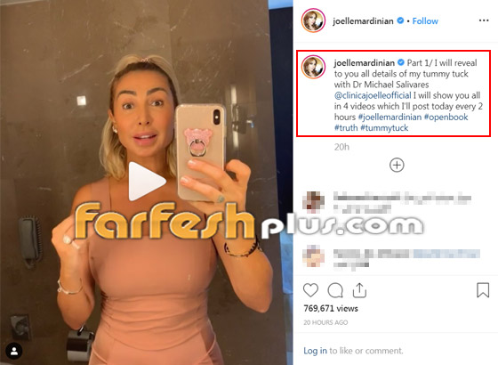 جويل ماردينيان تفاجئ متابعيها وتكشف عن عمليات التجميل التي خضعت لها! صورة رقم 1