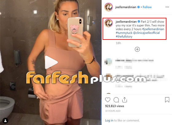 جويل ماردينيان تفاجئ متابعيها وتكشف عن عمليات التجميل التي خضعت لها! صورة رقم 2