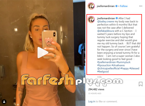 جويل ماردينيان تفاجئ متابعيها وتكشف عن عمليات التجميل التي خضعت لها! صورة رقم 3