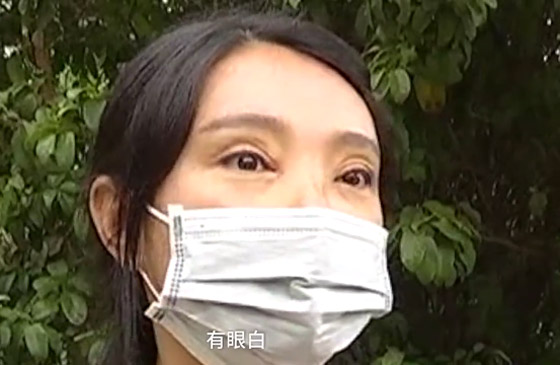عملية تجميل.. تحرمها من إغلاق عينيها صورة رقم 2