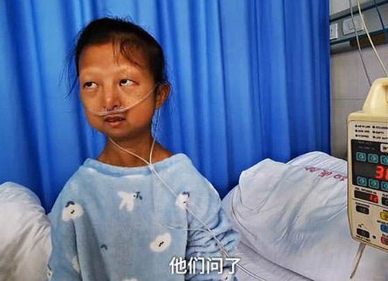 وزنها أصبح 21 كغم.. غضب في الصين لأجل شابة تدعم أخاها المريض! صورة رقم 2