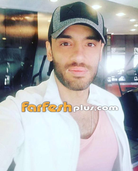 رامي جمال في أول ظهور بعد إصابته بالبهاق.. هكذا بدا شكله! صور صورة رقم 8