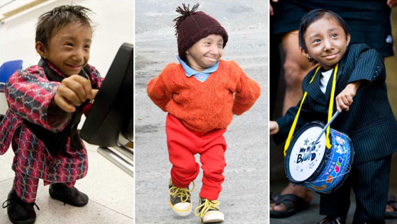 وفاة أقصر رجل في العالم صورة رقم 1 وفاة أقصر رجل في العالم صورة رقم 1