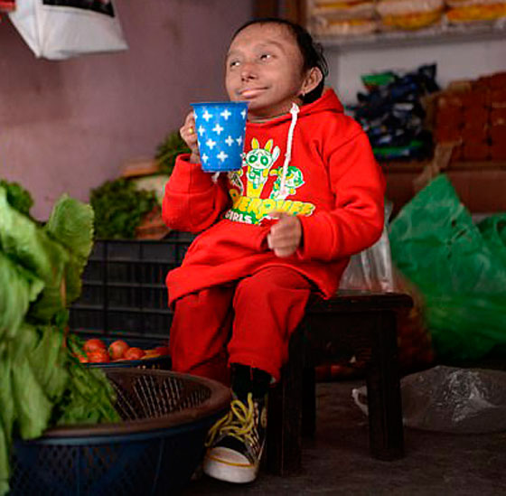 وفاة أقصر رجل في العالم صورة رقم 11 وفاة أقصر رجل في العالم صورة رقم 11