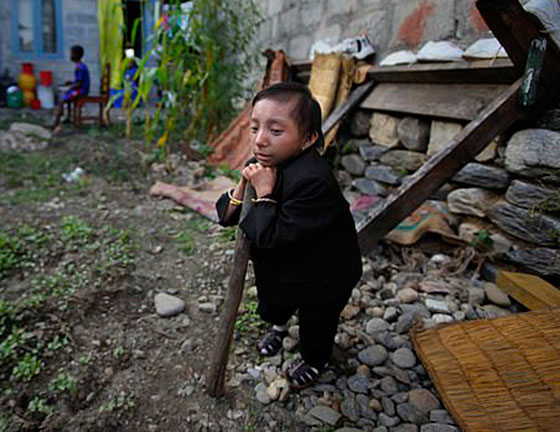 وفاة أقصر رجل في العالم صورة رقم 15 وفاة أقصر رجل في العالم صورة رقم 15