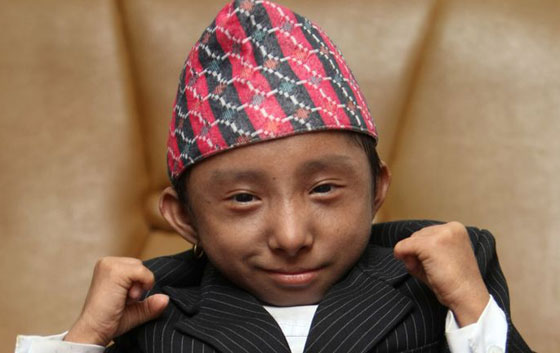 وفاة أقصر رجل في العالم صورة رقم 17 وفاة أقصر رجل في العالم صورة رقم 17