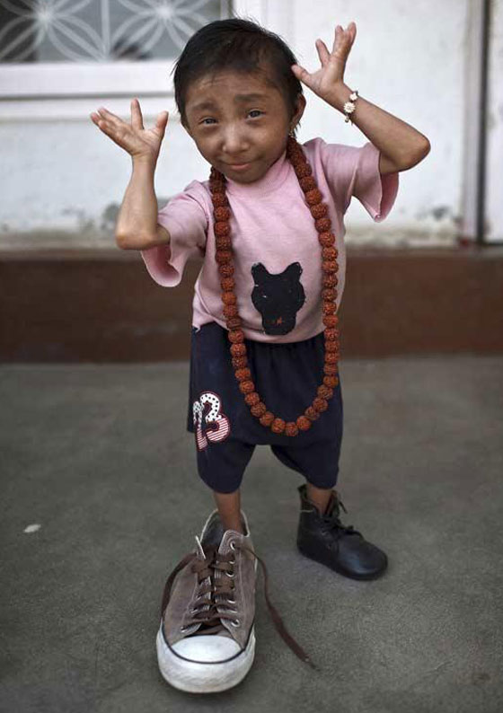 وفاة أقصر رجل في العالم صورة رقم 20 وفاة أقصر رجل في العالم صورة رقم 20