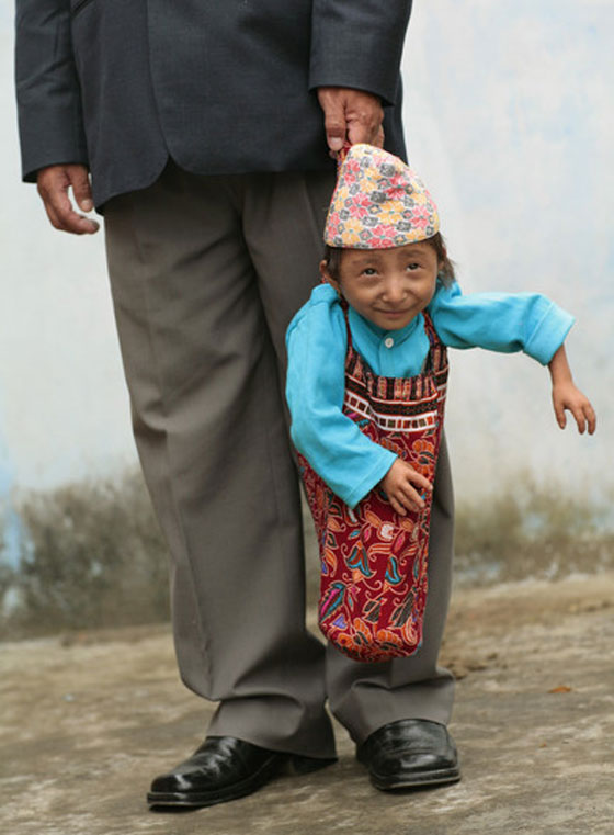 وفاة أقصر رجل في العالم صورة رقم 21 وفاة أقصر رجل في العالم صورة رقم 21