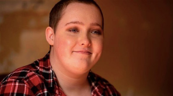 تنتزع خصلات شعرها 100 مرة يومياً بسبب هذه الحالة صورة رقم 1