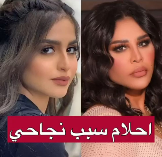  فيديو حلا الترك ترفض اعتزال الفن من اجل عريسها وماذا قالت عن احلام؟ صورة رقم 2
