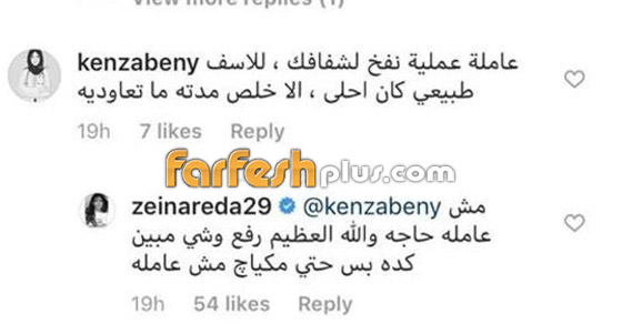 صور زينة تفضح حقيقة نفخ شفتيها وتشويه جمالها، وزينة تنكر العملية! صورة رقم 2