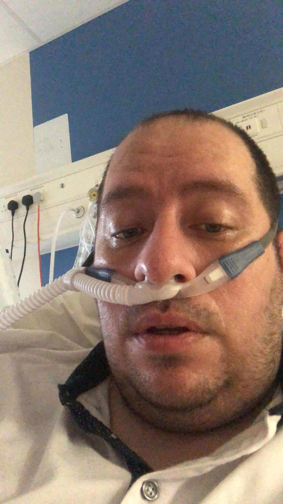 من سعال حاد لرئة منهارة تماما.. بريطاني يروي محنته مع كورونا صورة رقم 1