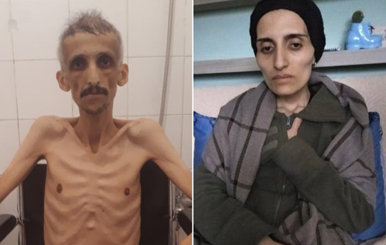 وفاة مغنية تركية..288 يوما بلا طعام احتجاجا على الحكومة صورة رقم 2