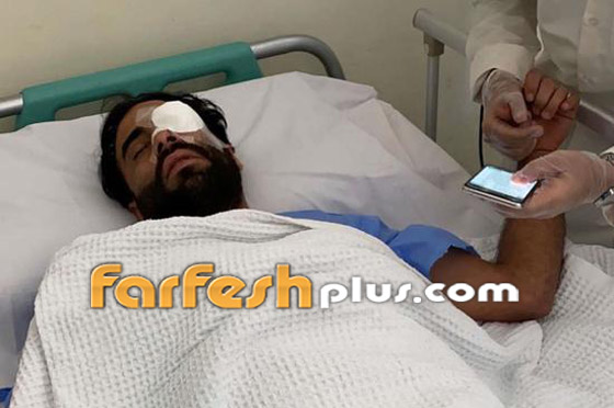 صور وفيديو: الإعلامي الكويتي عبودكا فقد عينه والقبض على المعتدين عليه صورة رقم 1