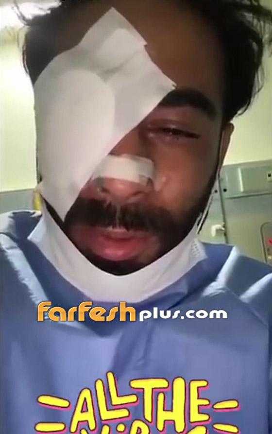صور وفيديو: الإعلامي الكويتي عبودكا فقد عينه والقبض على المعتدين عليه صورة رقم 4