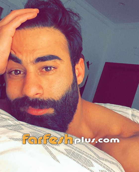 صور وفيديو: الإعلامي الكويتي عبودكا فقد عينه والقبض على المعتدين عليه صورة رقم 6