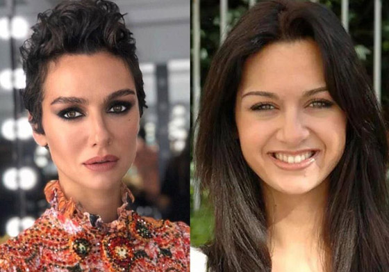 صور صادمة: للنجمات التركيات قبل وبعد عمليات التجميل صورة رقم 5