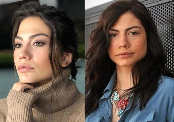 صور صادمة: للنجمات التركيات قبل وبعد عمليات التجميل صورة رقم 2