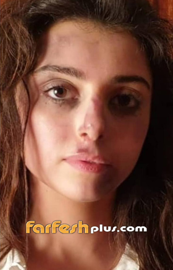 نجمات جريئات ظهرن بدون مكياج في مسلسلات رمضان 2020 صورة رقم 11