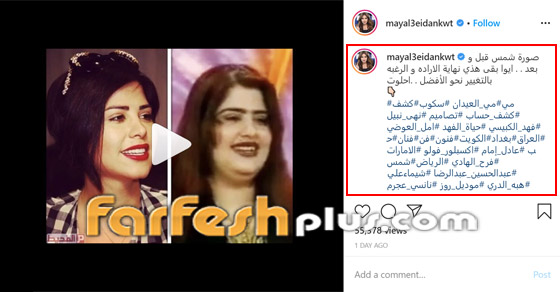مي العيدان تفضح شمس الكويتية وتنشر صورتها قبل وبعد التجميل! ماذا قالت؟ صورة رقم 1