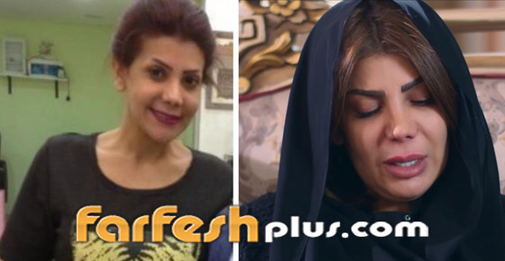 صور قبل وبعد للنجمات تُظهر تأثير عمليات التجميل (المكياج الدائم) صورة رقم 3