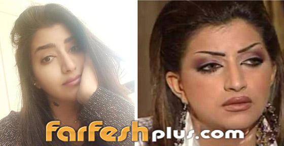 صور قبل وبعد للنجمات تُظهر تأثير عمليات التجميل (المكياج الدائم) صورة رقم 2
