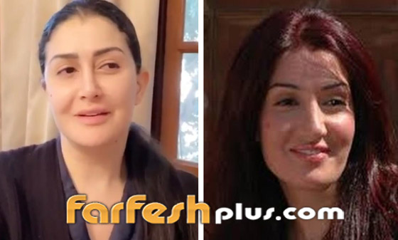 صور قبل وبعد للنجمات تُظهر تأثير عمليات التجميل (المكياج الدائم) صورة رقم 10