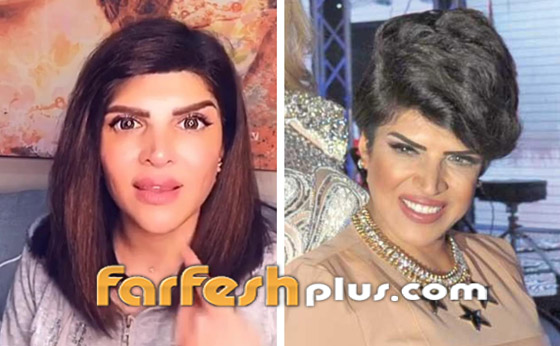 صور قبل وبعد للنجمات تُظهر تأثير عمليات التجميل (المكياج الدائم) صورة رقم 11