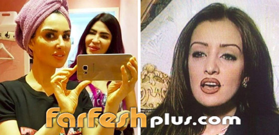صور قبل وبعد للنجمات تُظهر تأثير عمليات التجميل (المكياج الدائم) صورة رقم 16