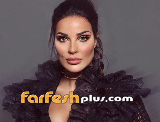 نادين نسيب نجيم تكشف عن صور وجهها المشوه لأول مرة بعد انفجار بيروت صورة رقم 25