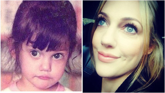 صور نادرة: نجوم بملامح مختلفة من الطفولة إلى الشهرة! الفرق صادم! صورة رقم 8