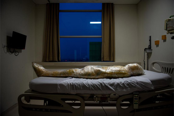 صورة مذهلة لأحد ضحايا كورونا يبدو فيها كأنه من كوكب آخر! صورة رقم 5 صورة مذهلة لأحد ضحايا كورونا يبدو فيها كأنه من كوكب آخر! صورة رقم 5