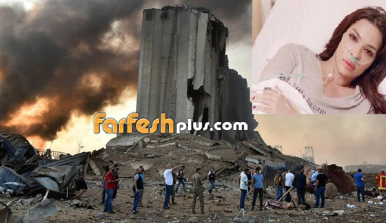نادين نجيم عقب إصابتها فى انفجار بيروت: بشكر ربي لأنه أعطانى عمرا جديدا صورة رقم 6