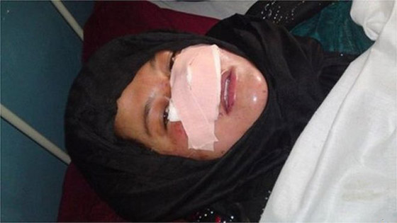 العنف الأسري: قطع أنف زوجته بالسكين لأنها غادرت المنزل بدون إذنه! صورة رقم 10