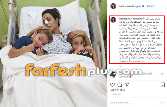 نادين نجيم تنفجر غضبا على متابع اتهمها باستغلال الانفجار للخضوع لعملية تجميل! صورة رقم 2