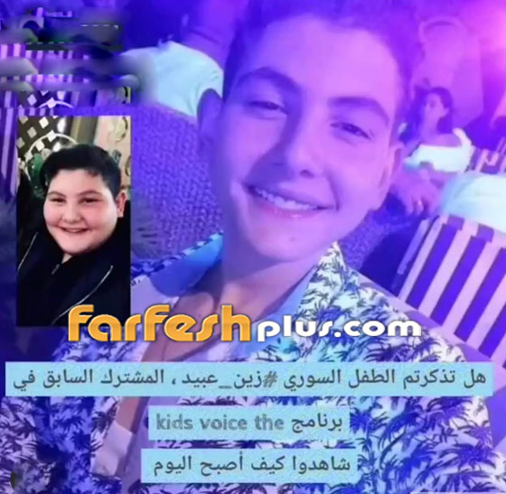 صور: لن تصدق كيف أصبح شكل الطفل زين عبيد نجم ذا فويس كيدز! صورة رقم 5