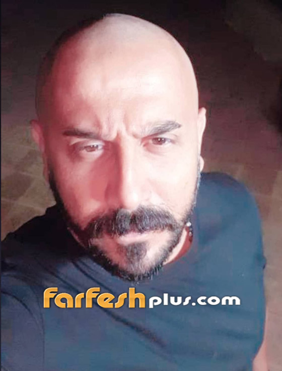 الفنان قصي خولي يتخلى عن شعره تماما.. والجمهور يشبهه بأحمد مكي صورة رقم 1