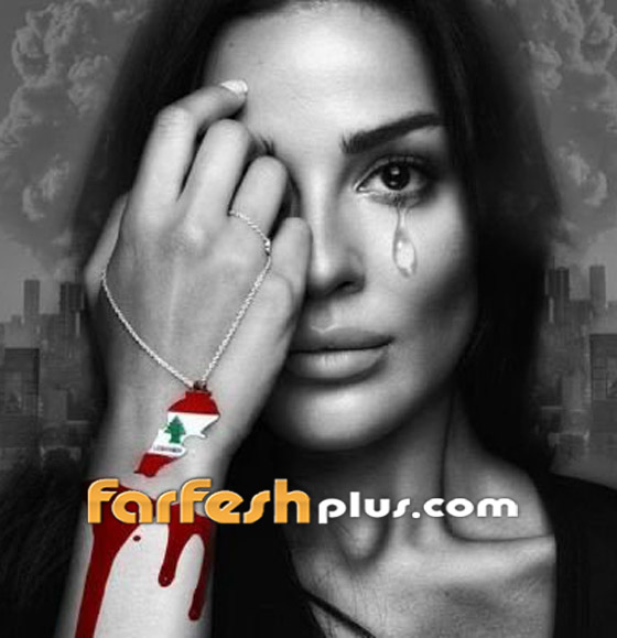 نادين نجيم عن الإنفجار: لم أشاهد سوى الدماء.. وحياتي كانت على المحك صورة رقم 2