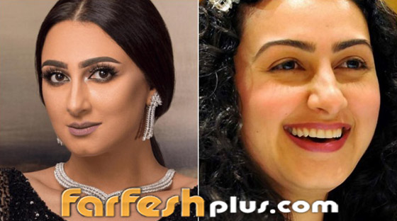 بالصور: نجمات عربيات قبل وبعد تصغير الأنف.. لن تصدق مظهرهن! صورة رقم 2