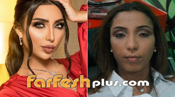 بالصور: نجمات عربيات قبل وبعد تصغير الأنف.. لن تصدق مظهرهن! صورة رقم 3